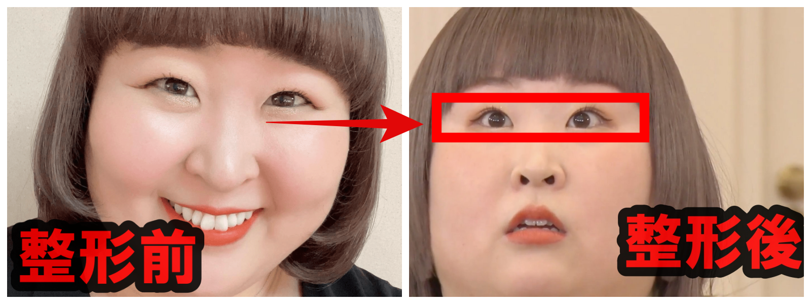 3時のヒロインのかなで目を整形