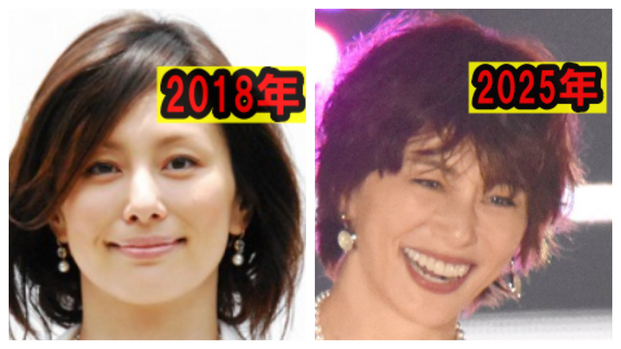 米倉涼子の頬の画像