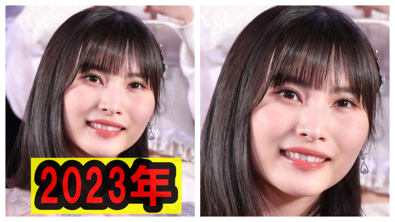 福岡聖菜の整形後