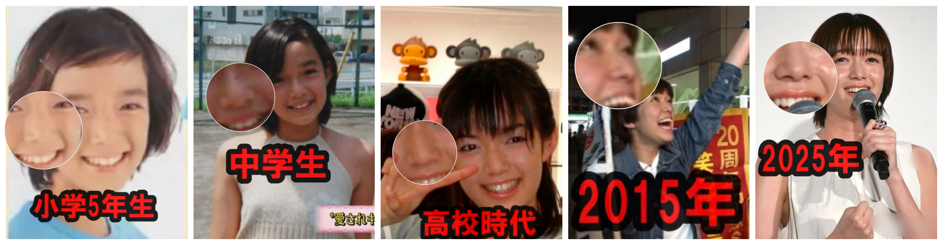 佐藤栞里の鼻画像