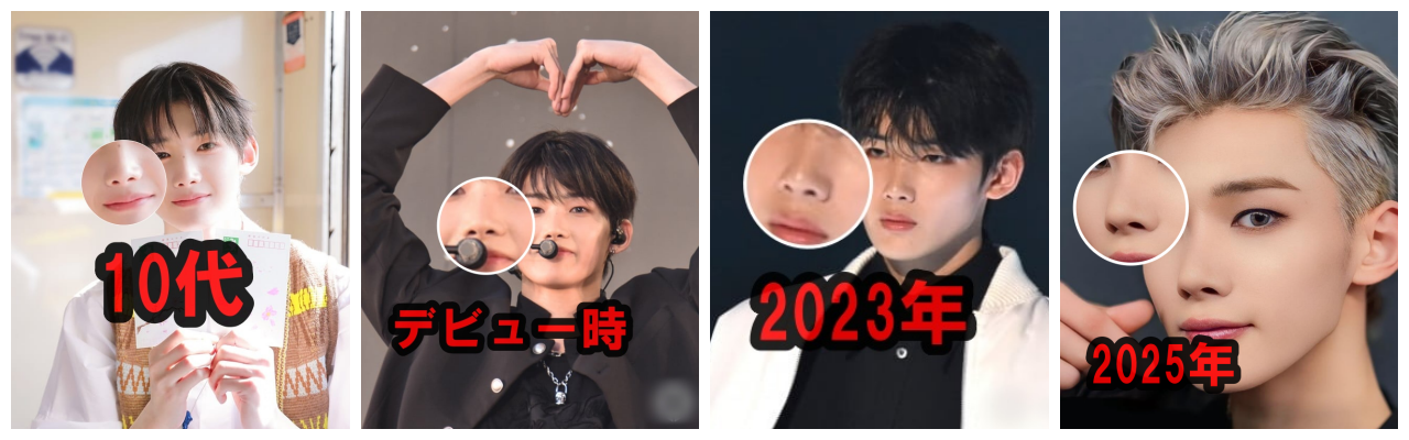 &TEAM JOの鼻画像