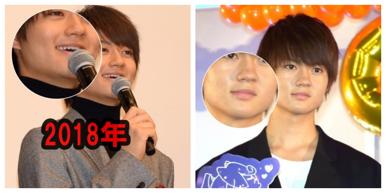 佐野勇斗の輪郭画像