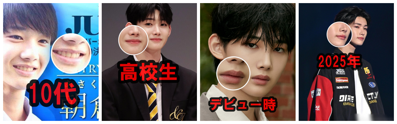 &TEAM JOの口画像